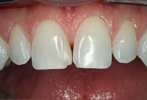 Emerald Smiles Dental | Periodontal Treatment, Night Guards and All-on-6 reg 